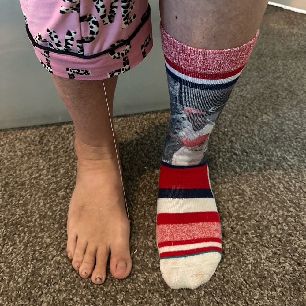 Worn single used Stance sock